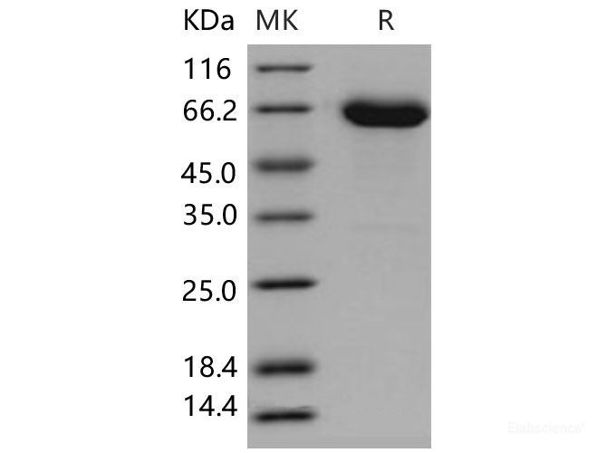 Recombinant Mouse EphA6 / EHK-2 Protein (His tag)-Elabscience