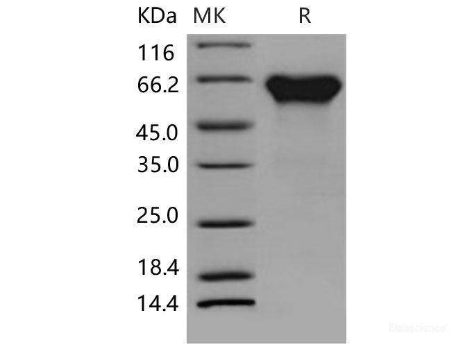 Recombinant Mouse ACVR2A / ActrIIa Protein (His & Fc tag)-Elabscience