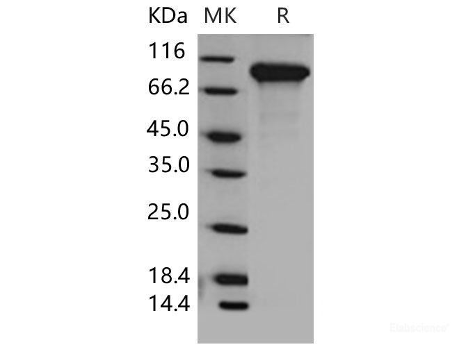 Recombinant Mouse DDR2 Kinase / CD167b Protein (His tag)-Elabscience