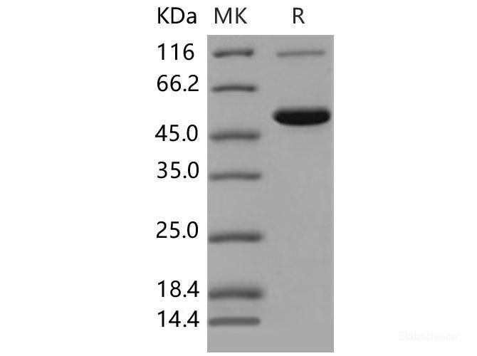 Recombinant Mouse CES2 / Carboxylesterase-2 Protein (His tag)-Elabscience