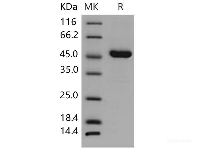 Recombinant Mouse AGER / RAGE Protein (His tag)-Elabscience