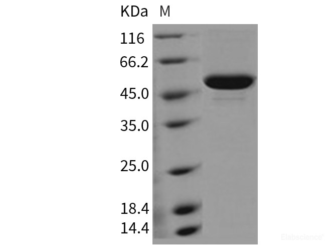 Recombinant Mouse CES3 / Carboxylesterase-3 / CES1D Protein (His tag)-Elabscience