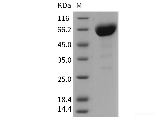 Recombinant Mouse CD147 / EMMPRIN / Basigin Protein (His & Fc tag)-Elabscience