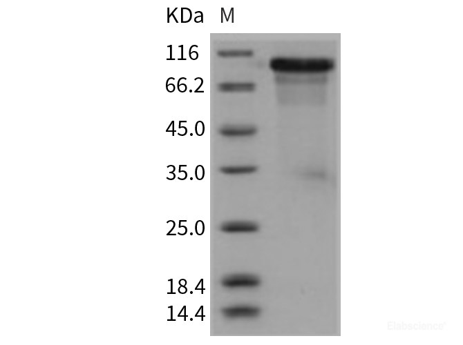 Recombinant Mouse ECM1 Protein (His tag)-Elabscience