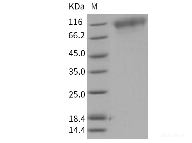 Recombinant Mouse TrkC / NTRK3 Protein (His tag)-Elabscience