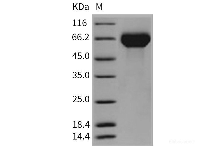 Recombinant Mouse Hemopexin / HPX Protein (His tag)-Elabscience
