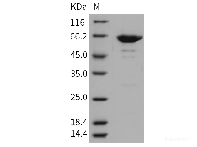 Recombinant Mouse Leukotriene A4 Hydrolase / LTA4H Protein (His tag)-Elabscience