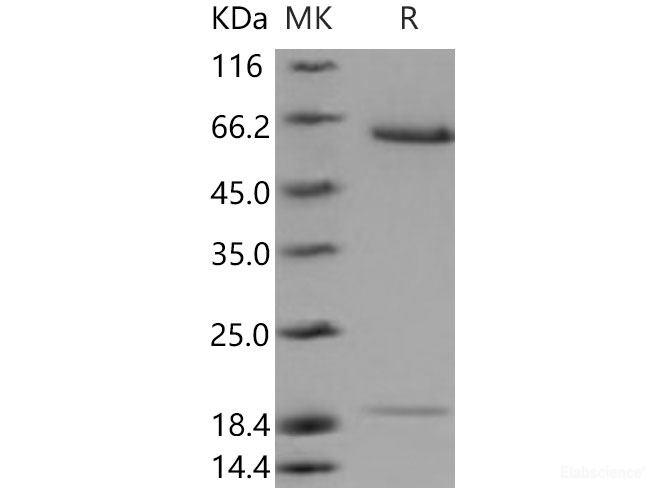 Recombinant Mouse PCSK9 / NARC1 Protein (His tag)-Elabscience