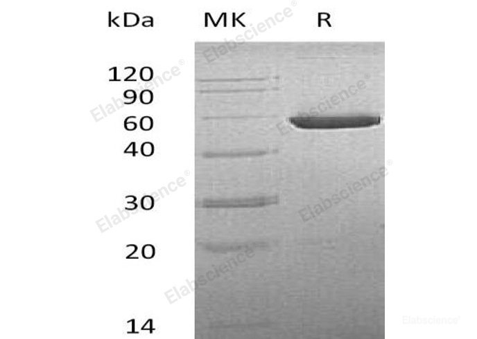 Recombinant Mouse  CNDP2 Protein (His Tag)-Elabscience