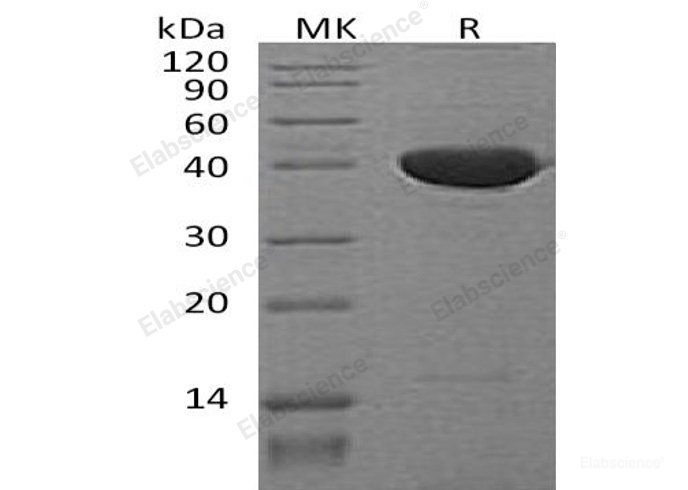 Recombinant Mouse  PEDF Protein (His Tag)-Elabscience