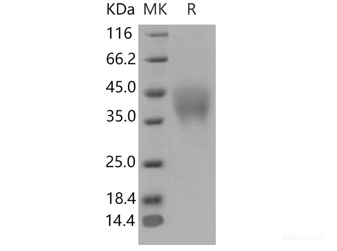 Recombinant Mouse PILR-alpha / PILRA Protein (His tag)-Elabscience