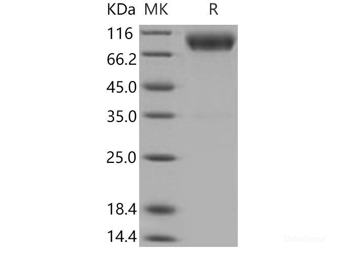 Recombinant Mouse CD200R1 Protein (His & Fc tag)-Elabscience