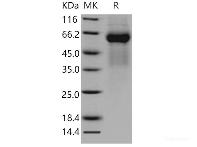 Recombinant Mouse FGFRL1 / FGFR5 Protein (His tag)-Elabscience