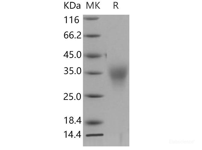 Recombinant Mouse ACTRIIB / ACVR2B Protein (His tag)-Elabscience