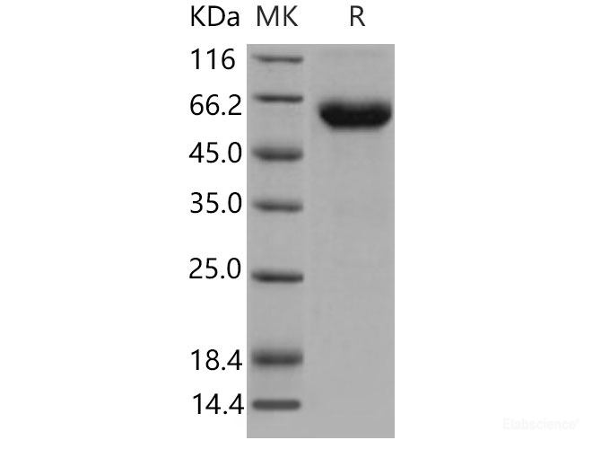 Recombinant Mouse ACVR2B Protein (His & Fc tag)-Elabscience