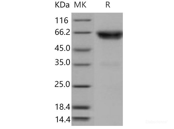 Recombinant Mouse TNFR2 / CD120b / TNFRSF1B Protein (Fc tag)-Elabscience
