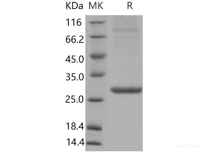 Recombinant Mouse  Serum Amyloid P Protein (His Tag)-Elabscience