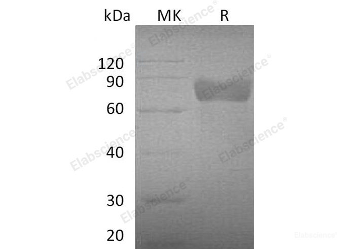 Recombinant Mouse  Growth Hormone Receptor Protein (His Tag)-Elabscience