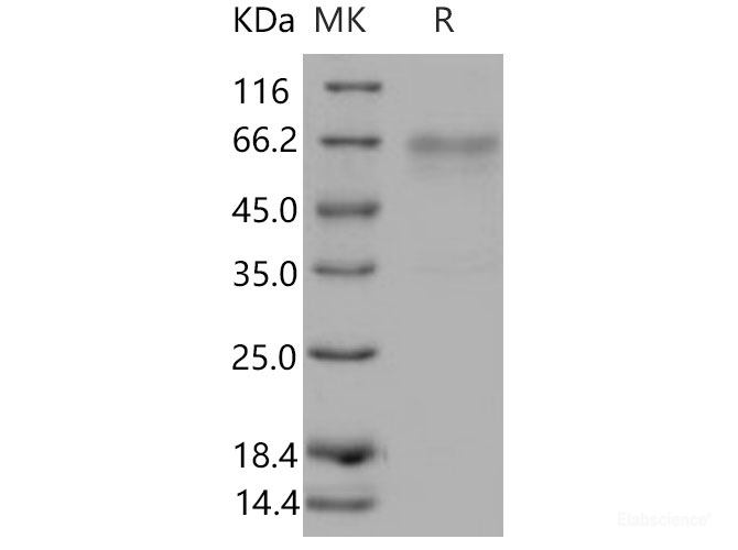 Recombinant Mouse HVEM / TNFRSF14 Protein (His & Fc tag)-Elabscience