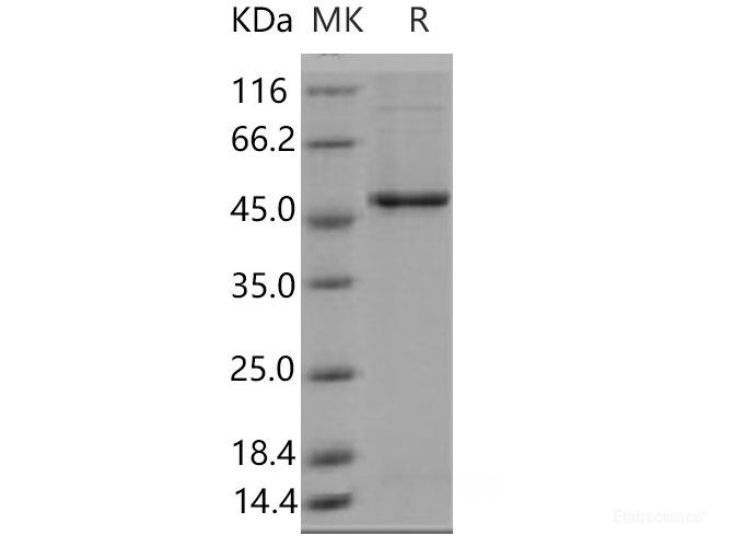 Recombinant Mouse GSK3B Protein (His tag)-Elabscience