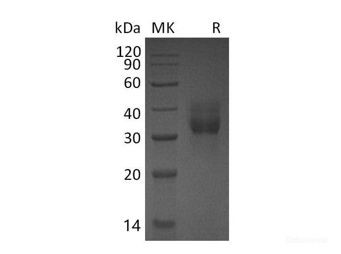 Recombinant Mouse Cathepsin B Protein-Elabscience