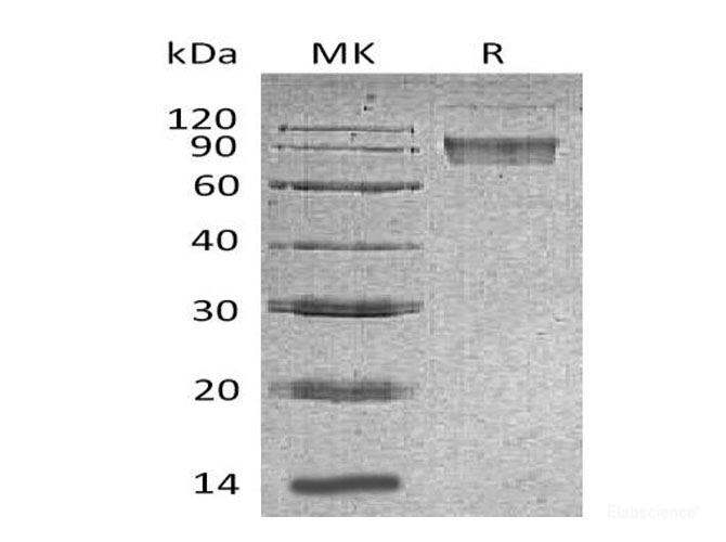 Recombinant Mouse B7-H4 Protein-Elabscience