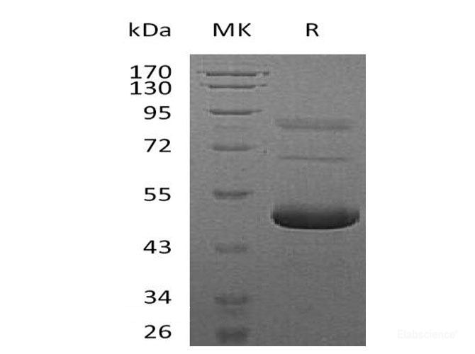 Recombinant Mouse Ephrin-A5/EFNA5 Protein(C-6His)-Elabscience