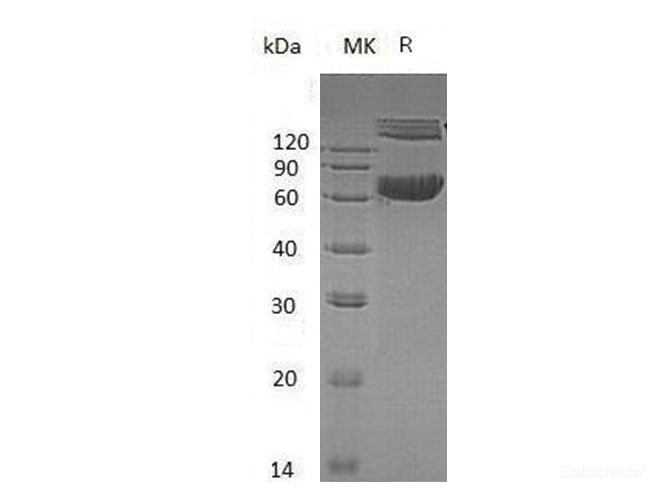 Recombinant Mouse Ephrin-B1/EFNB1 Protein(C-Fc-6His)-Elabscience