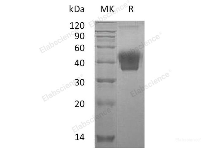 Recombinant Mouse M-CSF/CSF1 Protein(C-6His)-Elabscience