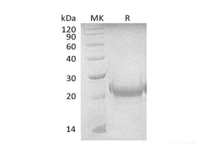 Recombinant Mouse OX40 Ligand/TNFSF4/OX40L Protein(N-8His) -Elabscience