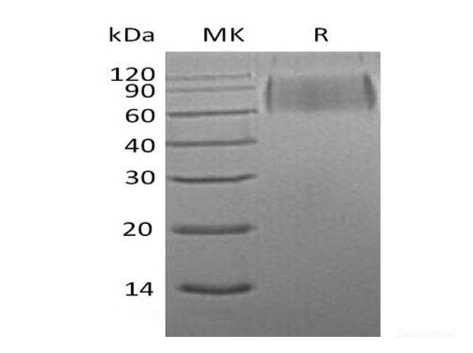 Recombinant Mouse Signal-Regulatory Protein α-1/SIRPA/CD172a Protein(C-6His) -Elabscience