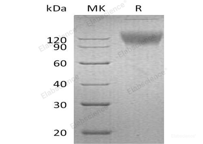 Recombinant Mouse Signal-Regulatory Protein α-1/SIRPA/CD172a Protein(C-Fc) -Elabscience