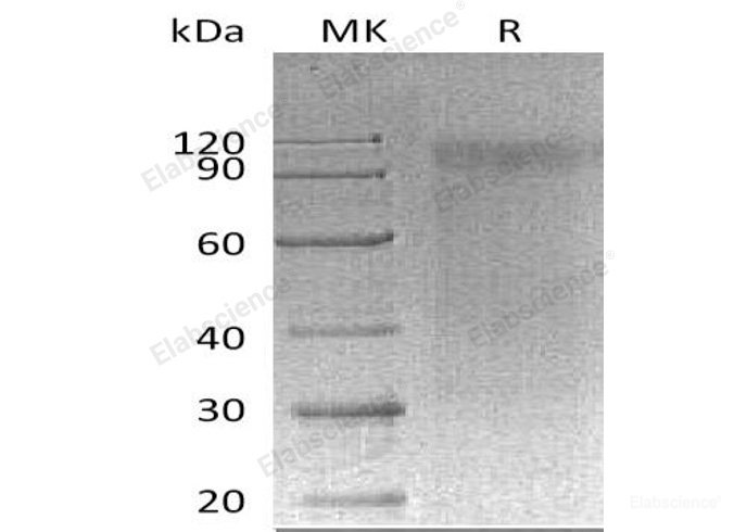 Recombinant Mouse Signal-Regulatory Protein α-1/SIRPA/CD172a Protein(C-MIgG2a) -Elabscience
