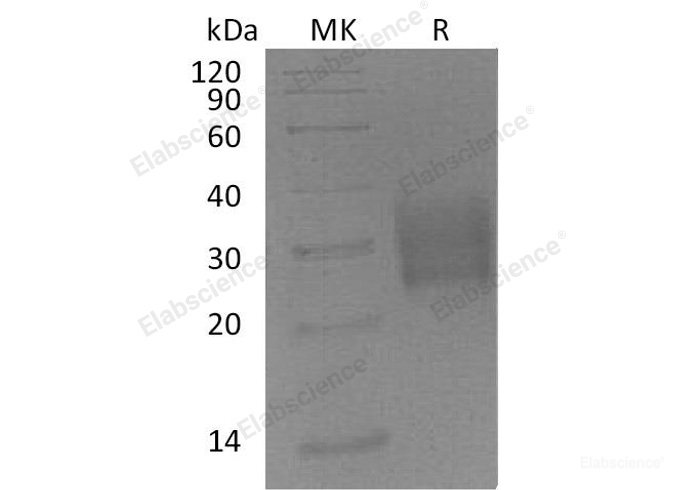 Recombinant Mouse Transforming Growth Factor-β Receptor Type II/TGFBR2 Protein(C-6His) -Elabscience