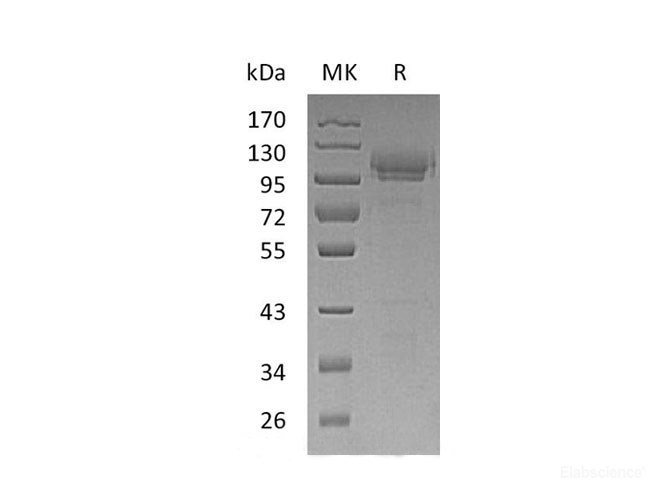 Recombinant Mouse Cell adhesion molecule 1 Protein-Elabscience