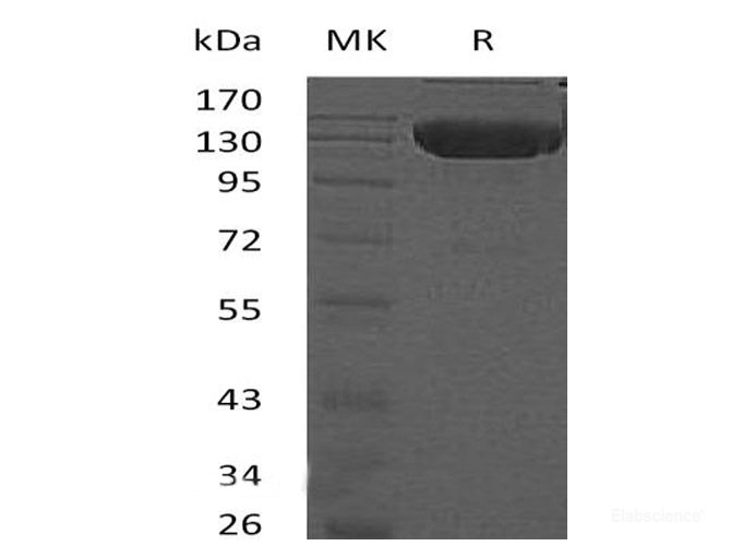 Recombinant Mouse Death Receptor 6 Protein-Elabscience