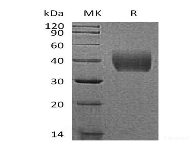 Recombinant Mouse TissueFactor / TF Protein (C-His)-Elabscience