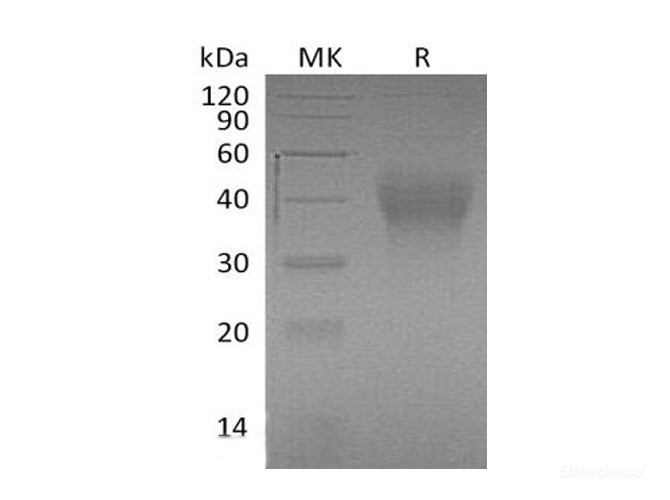 Recombinant Mouse TIM-3 / HAVCR2 Protein (C-His)-Elabscience