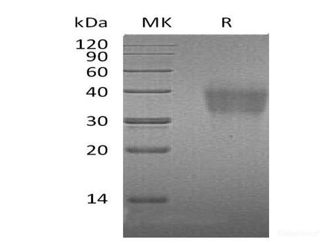 Recombinant Mouse PD-1 / CD279 / PDCD1 Protein (C-His)-Elabscience