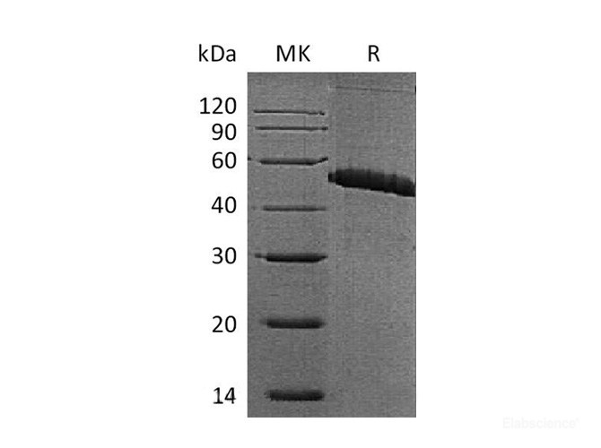 Recombinant Mouse Platelet Glycoprotein 4 / CD36 Protein (C-Fc)-Elabscience