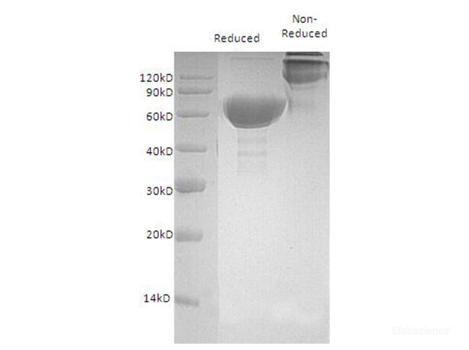 Recombinant Mouse OX40 / TNFRSF4 Protein (N-Fc)-Elabscience