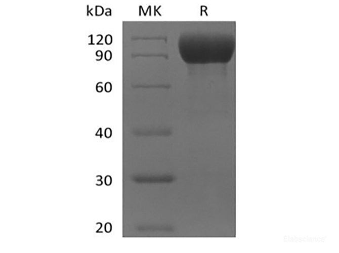 Recombinant Mouse IL-1 Receptor-Like 2/IL-1RL2/IL-1Rrp2/IL-36R (C-Fc)
