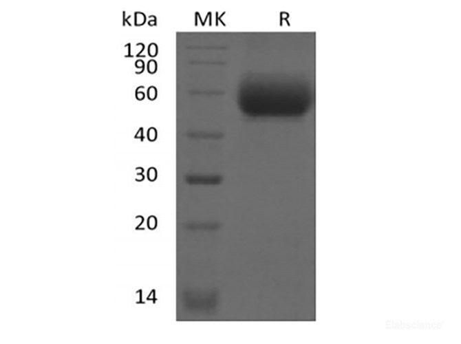 Recombinant Mouse IL-1 Receptor-Like 2/IL-1RL2/IL-1Rrp2/IL-36R (C-6His)