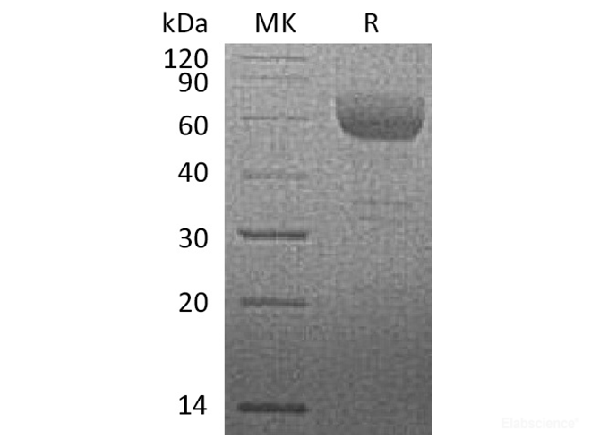 Recombinant Rhesus macaque HVEM / TNFRSF14 / CD270 Protein (C-Fc)-Elabscience
