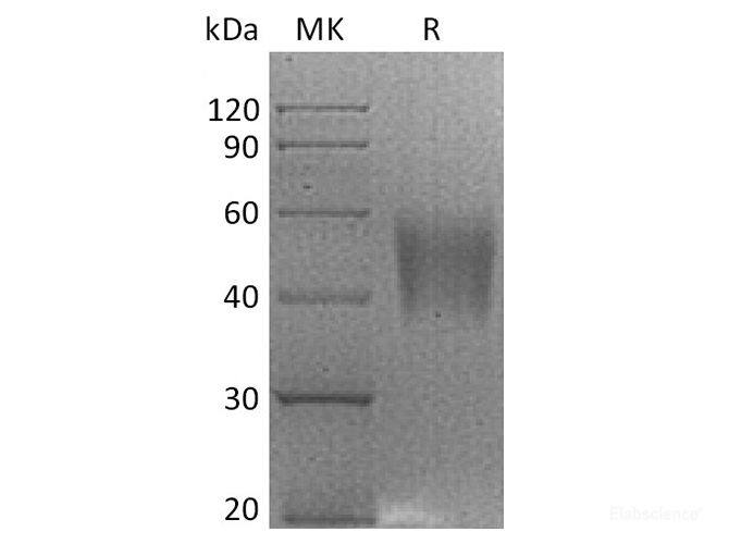 Recombinant Rhesus macaque B7-H4 / VTCN1 Protein (C-His)-Elabscience