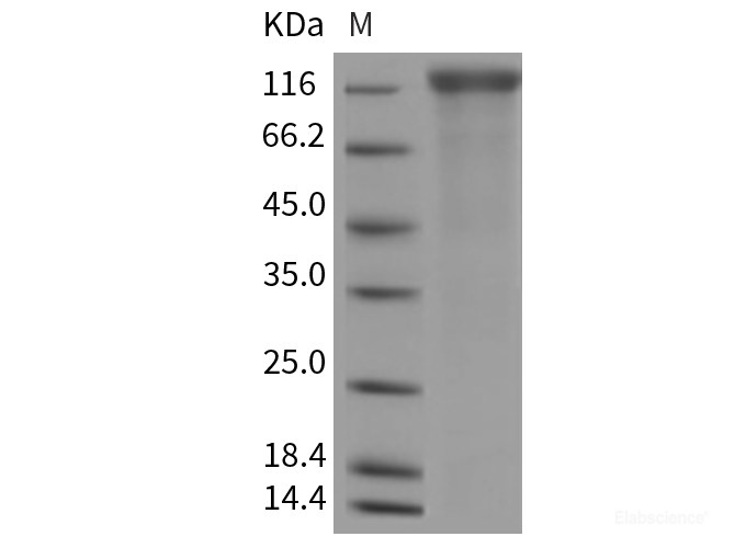 Recombinant Rat VEGFR2 / Flk-1 / CD309 / KDR Protein (His tag)-Elabscience