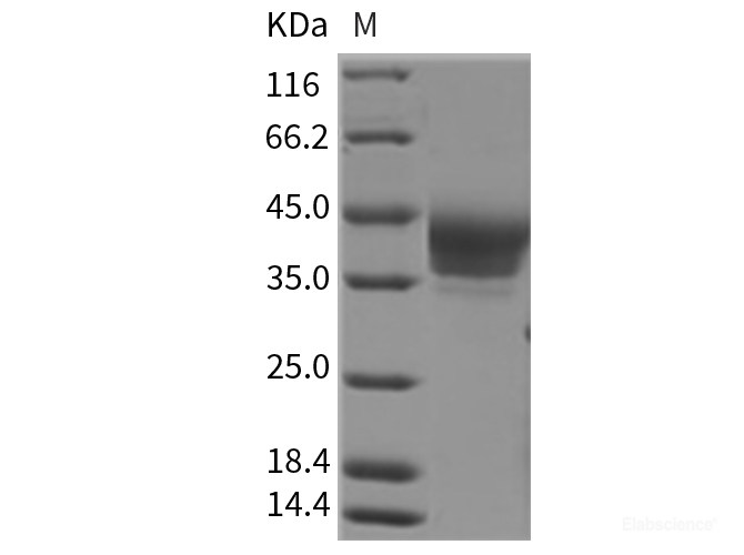 Rat B7-H6 / B7H6 / NCR3LG1 Protein (His Tag)-Elabscience