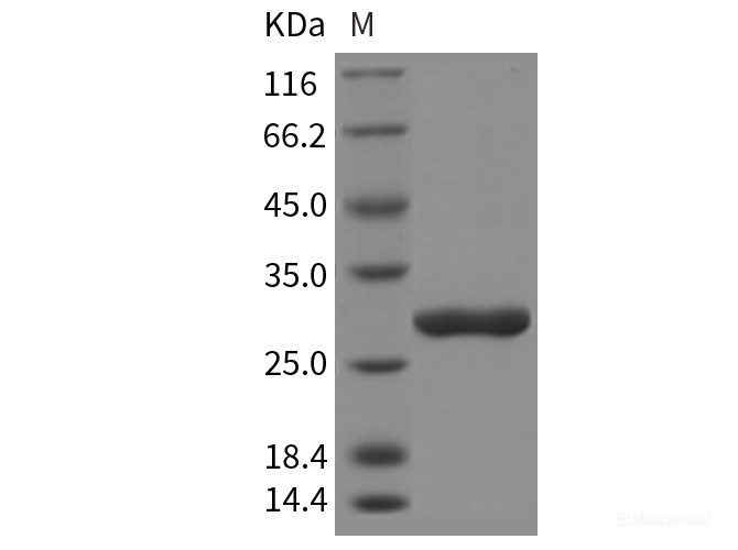 Rat CTRB1 / Chymotrypsinogen B1 Protein (His Tag)-Elabscience