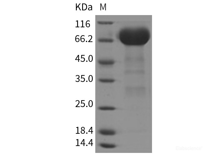 Recombinant Rat EphA3 Protein (His tag)-Elabscience