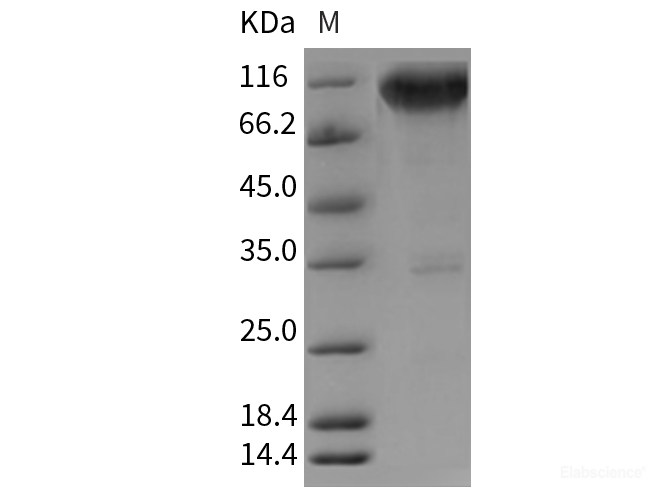 Recombinant Rat TrkA / NTRK1 Protein (Fc tag)-Elabscience